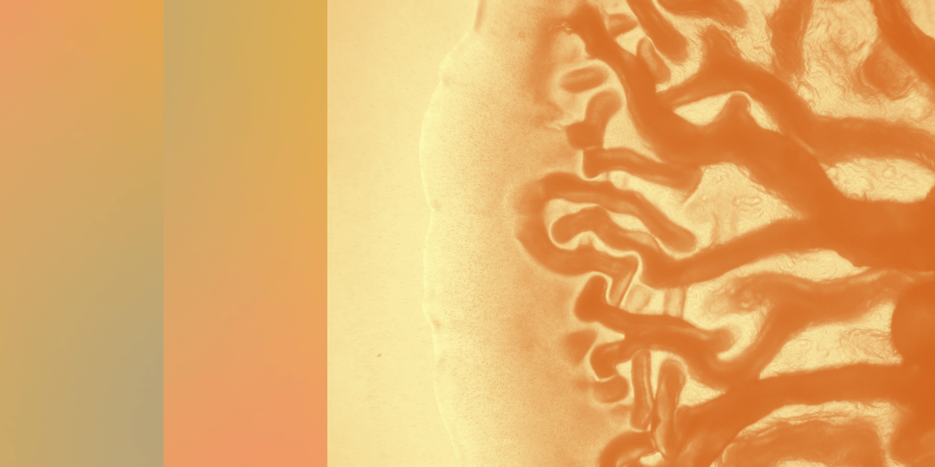 Blog Post Featured Image