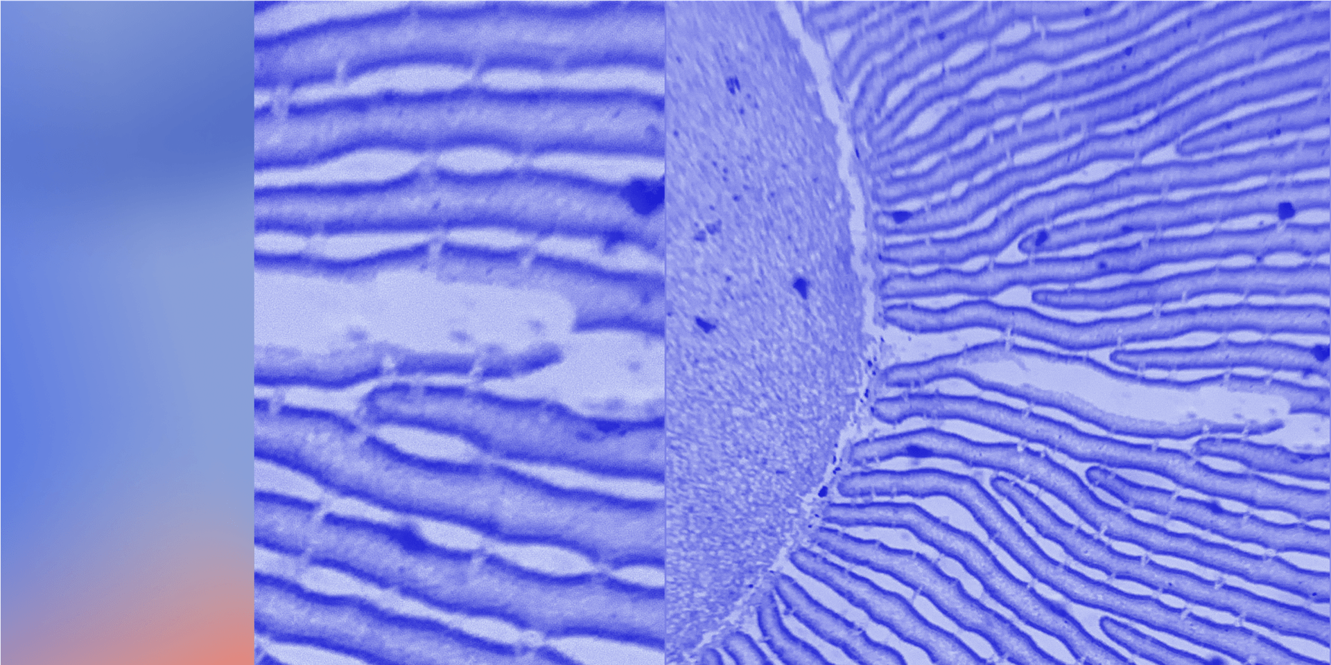 Blog Post Featured Image